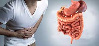 Anorectal Disorders