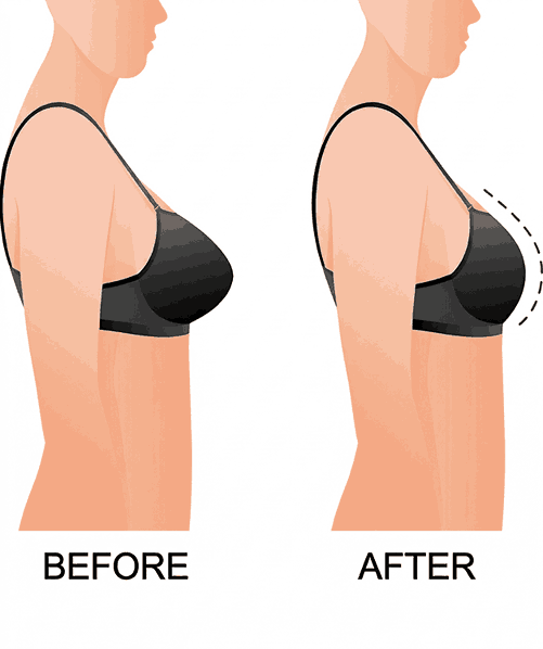 Surgery & Recovery