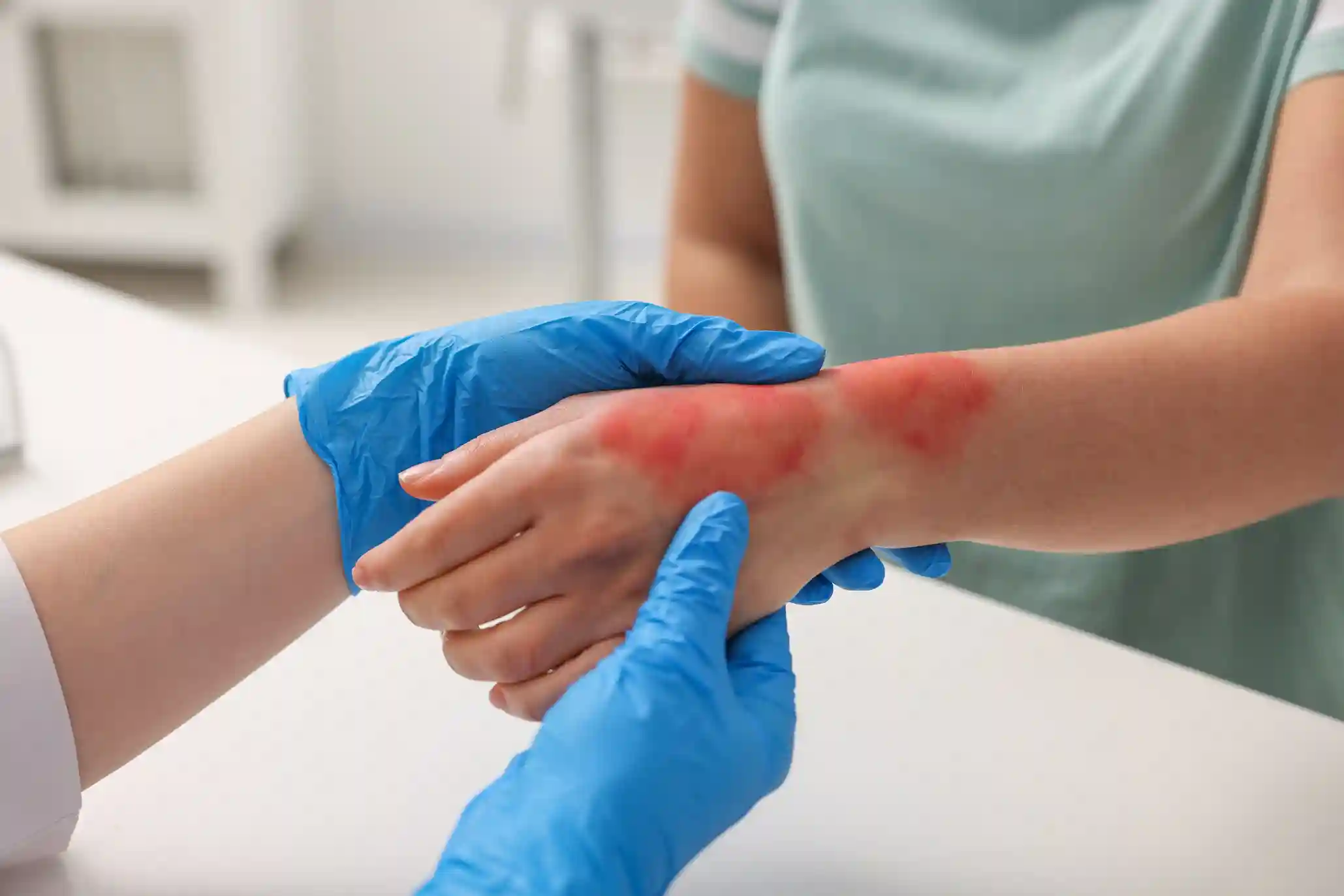 Burn & Wound Care