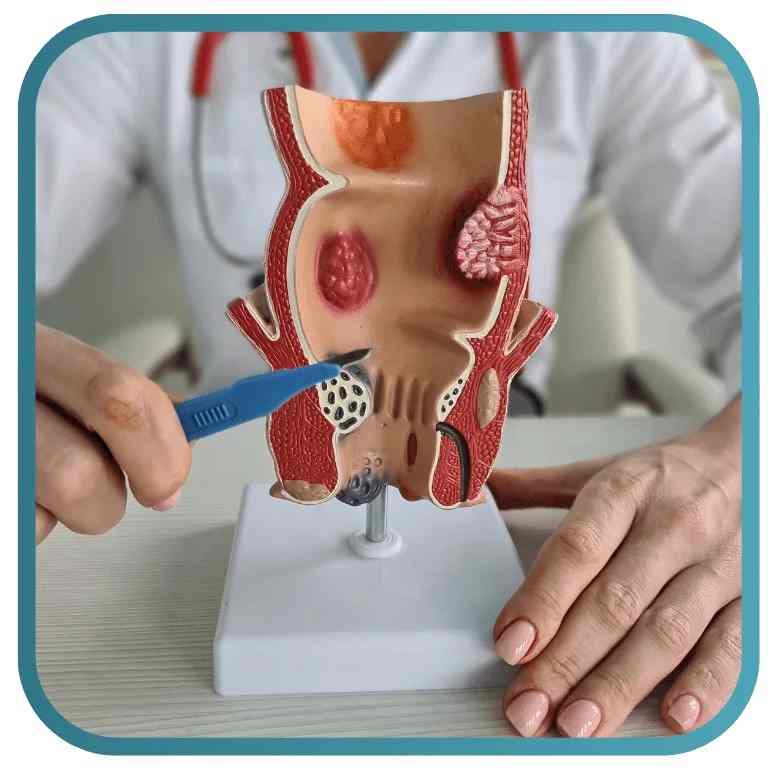 Laser Fissure Surgery