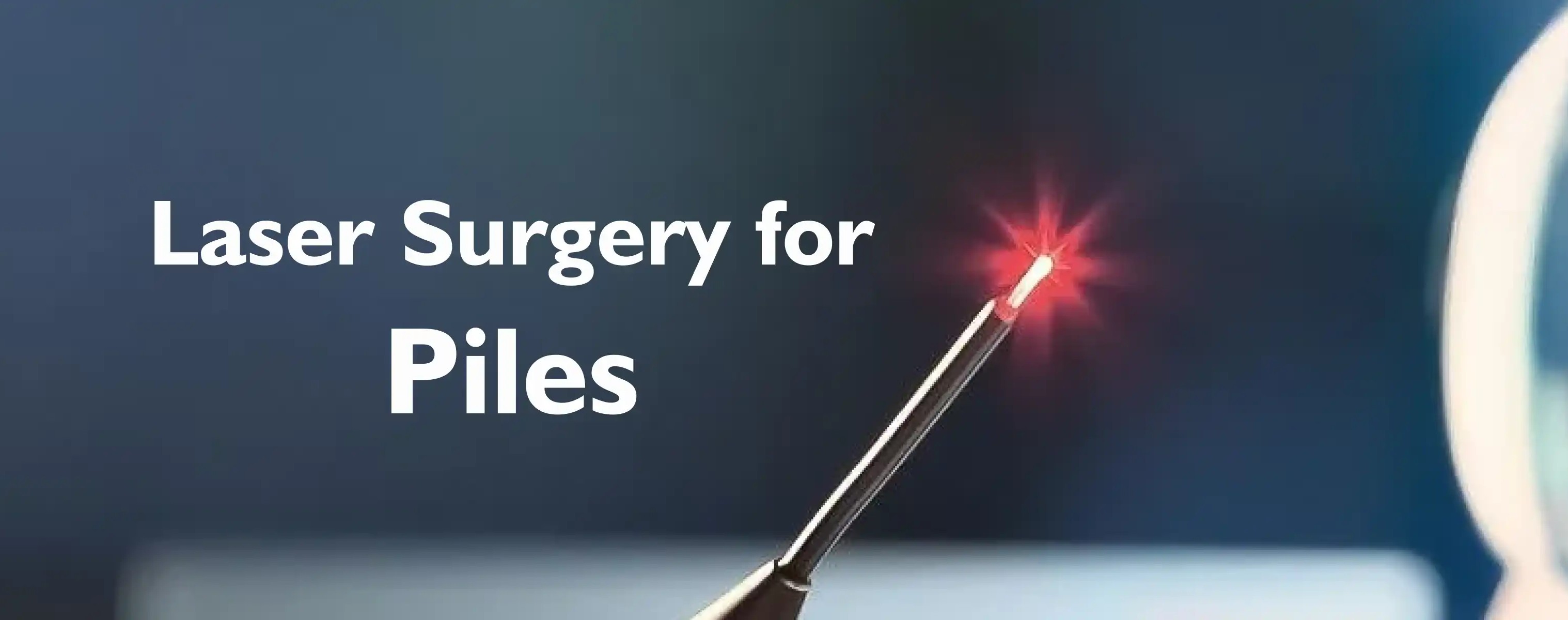 Laser Piles Treatment